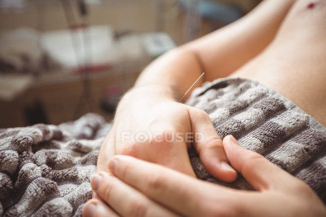 Gros plan d'un patient qui se sèche à l'aiguille sur la main — Photo de stock