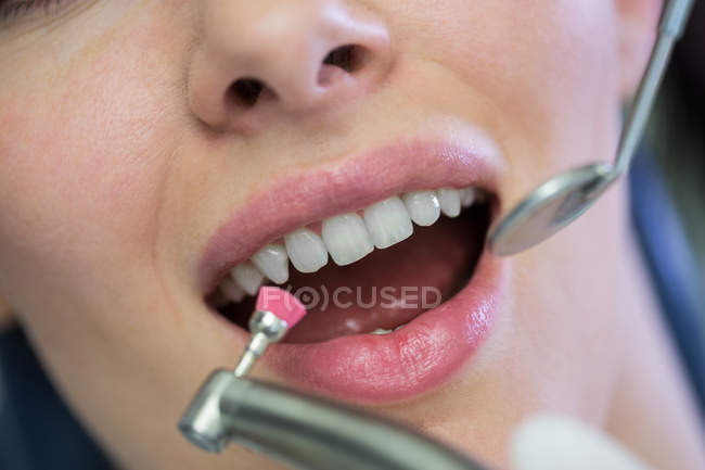 Dentista examinando uma paciente com ferramentas na clínica odontológica — Fotografia de Stock