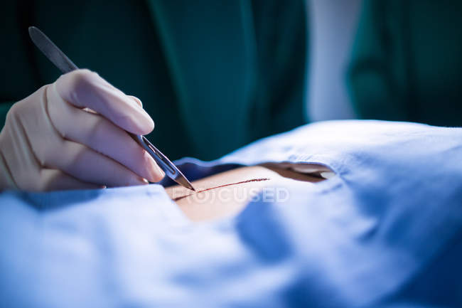 Cirurgião com bisturi realizando operação no teatro de operação do hospital — Fotografia de Stock