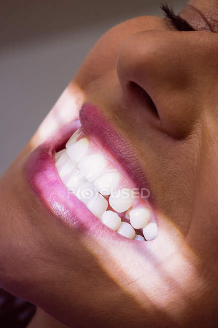 Patiente recevant un traitement par lumière dentaire à la clinique dentaire, gros plan — Photo de stock