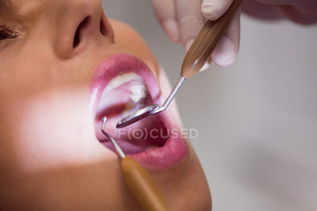 Primo piano del dentista che esamina i denti delle pazienti — Foto stock