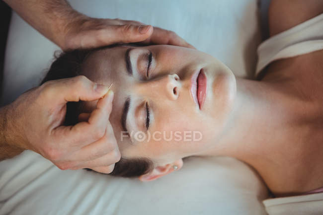 Fisioterapeuta masculino que administra tratamiento de acupuntura a una paciente femenina en la clínica - foto de stock