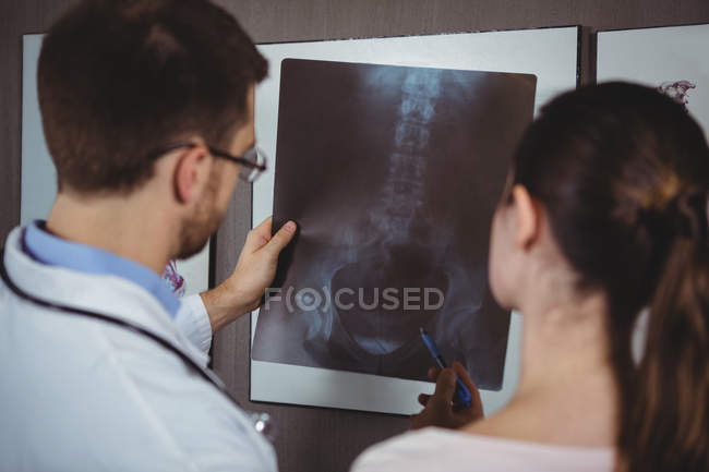 Fisioterapista che spiega la radiografia della colonna vertebrale alla paziente in clinica — Foto stock
