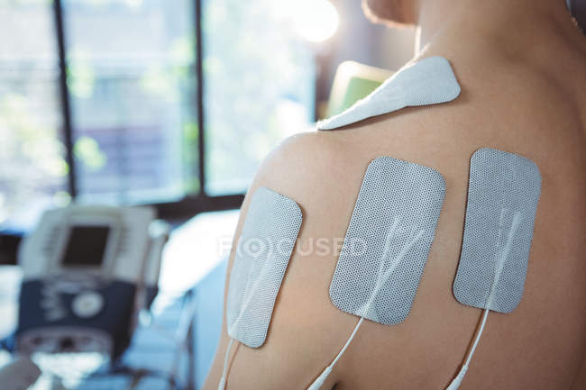 Gros plan du patient masculin avec électrodes électrostimulatrices sur le dos à la clinique — Photo de stock