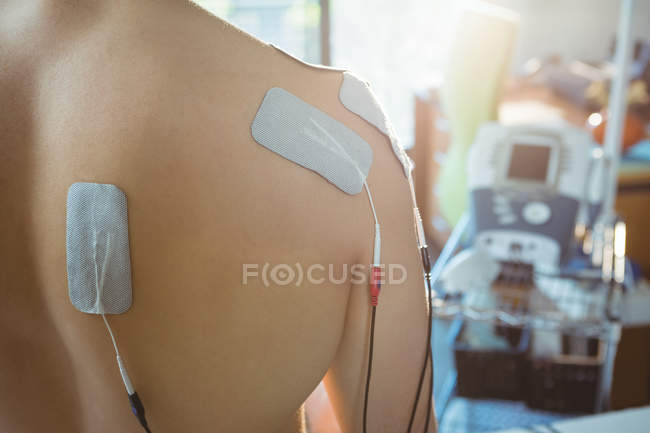 Vista posterior del paciente masculino con electrodos de electroestimulación en la espalda en la clínica - foto de stock
