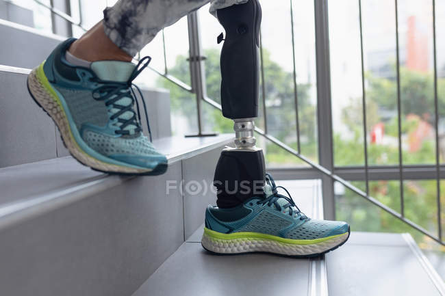 Low section of disabled female patient with prosthetic leg walking on stairs in hospital — Stock Photo