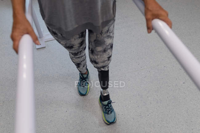 Baixa seção de paciente amputada do sexo feminino caminhando com barras paralelas no hospital — Fotografia de Stock