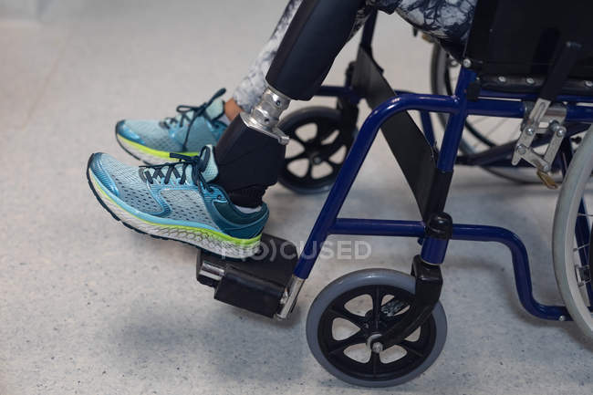 Sección baja de la paciente discapacitada sentada en silla de ruedas en el hospital - foto de stock