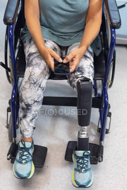 Sección baja de la paciente discapacitada usando teléfono móvil en silla de ruedas en el hospital - foto de stock