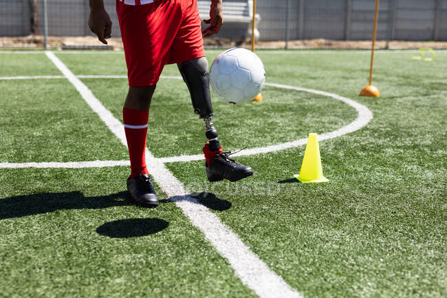 Male football player with prosthetic leg wearing a team strip training at a sports field in the sun, warming up kicking ball. — Stock Photo