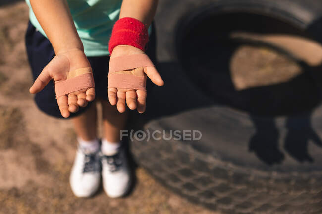 Mid section of girl at a boot camp on a sunny day, holding out and showing her injured hands with sticking plasters on her palms, wearing red sweatband, green t shirt and black shorts — Stock Photo
