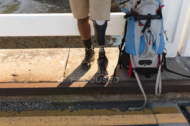 Low section of disabled male athlete with prosthetic leg, enjoying his time on a trip to the mountains, hiking, taking a break. Active lifestyle with disability. — Stock Photo