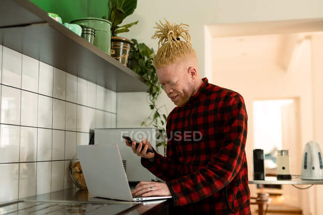 Albino homem americano africano com dreadlocks trabalhando em casa e usando laptop e smartphone. trabalho remoto usando a tecnologia em casa. — Fotografia de Stock