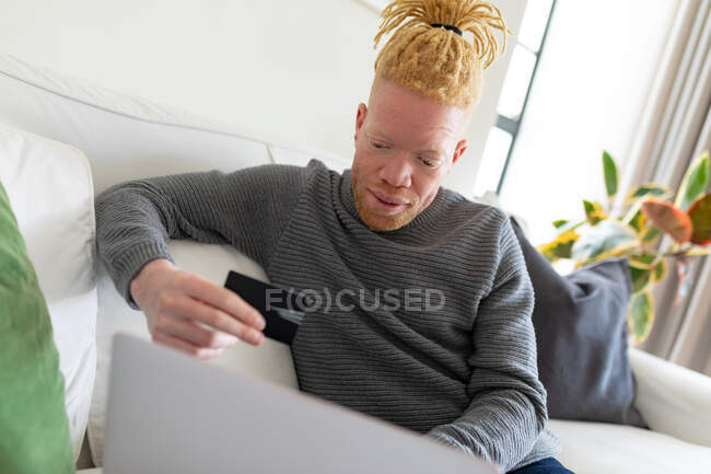 Albinoafrikanisch-amerikanischer Mann im Wohnzimmer beim Online-Shopping. Freizeit mit Technik, Entspannung zu Hause. — Stockfoto