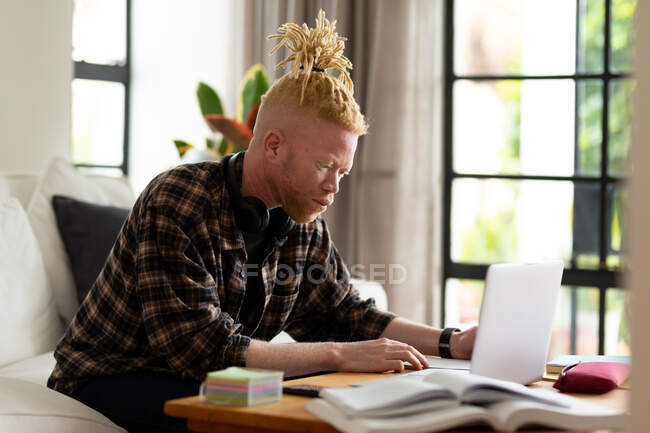 Albino uomo afroamericano con dreadlocks lavorare da casa e utilizzando il computer portatile. lavoro a distanza utilizzando la tecnologia a casa. — Foto stock