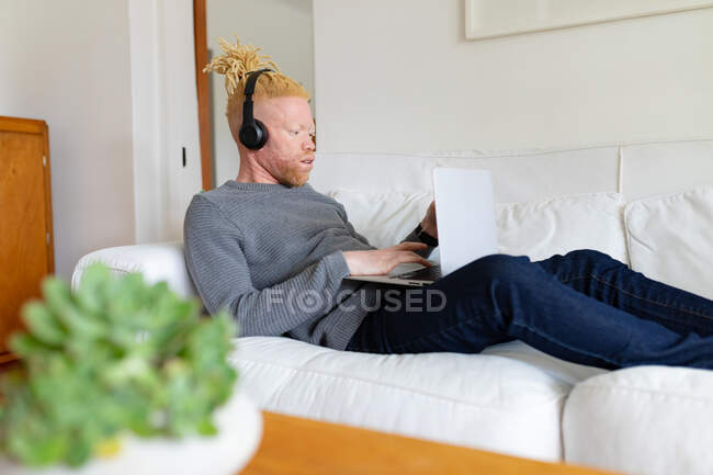 Homme afro-américain albinos dans le salon en utilisant un ordinateur portable. loisirs utilisant la technologie, détente à la maison. — Photo de stock