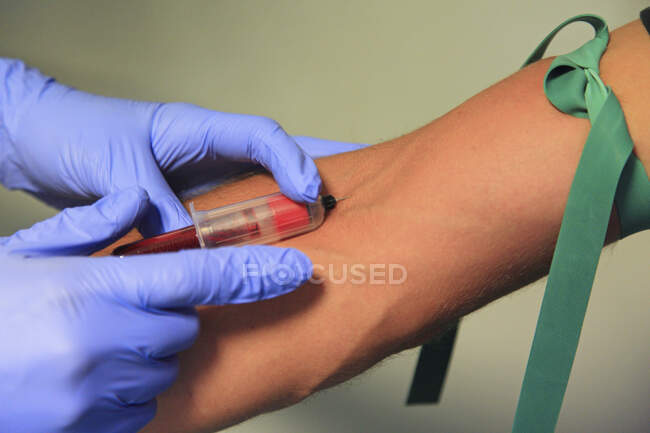 Gros plan du test sanguin — Photo de stock