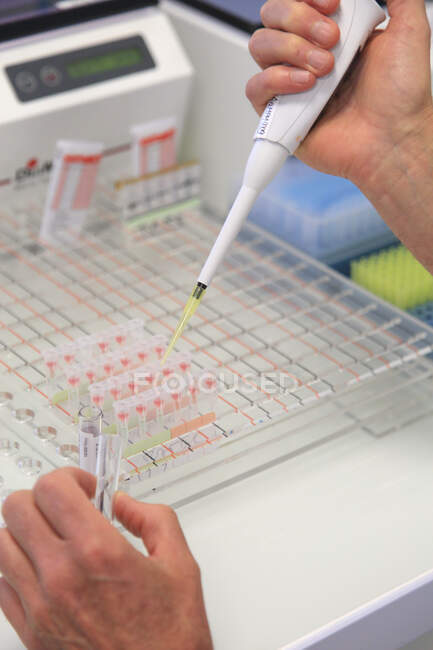 Close up of Blood tests — Stock Photo