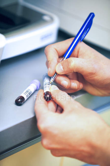 Vet writing on test tubes, Franc — Stock Photo