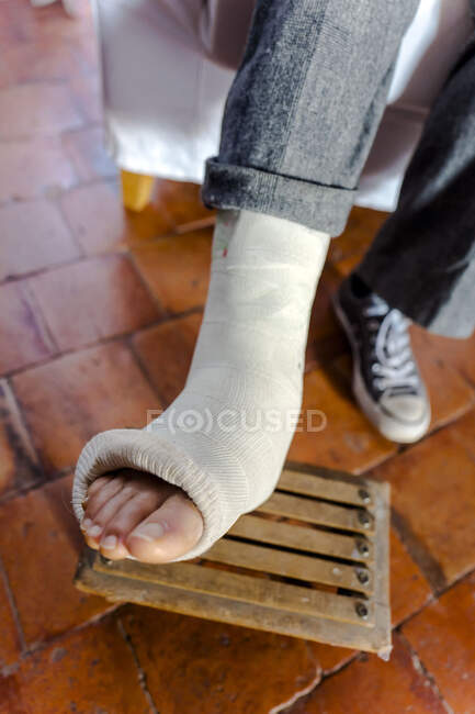 Close-up on a woman's feet in the plaster cast on a footrest in the countryside. — Stock Photo