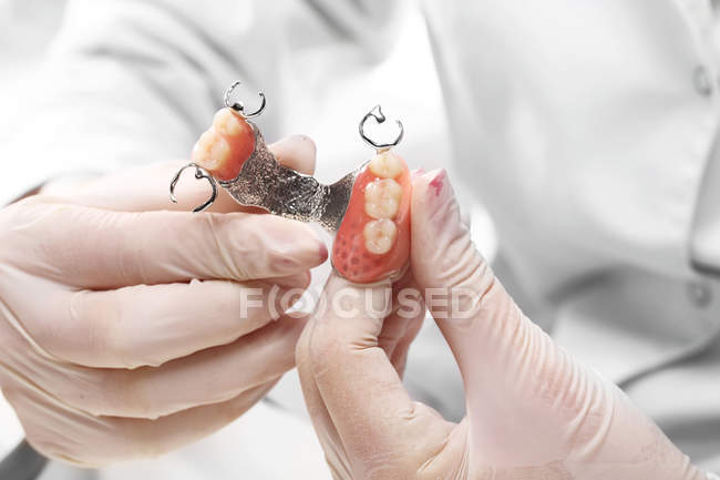 Carillas, dentaduras postizas, puentes protésicos en el trabajo - foto de stock