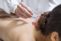 Woman receiving acupuncture in traditional chinese clinic — Stock Photo