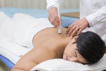 Chinese patient receiving moxibustion therapy — Stock Photo