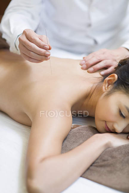 Mujer joven que recibe tratamiento de acupuntura, primer plano - foto de stock