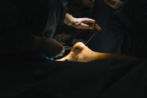 Surgeon sewing up leg after operation — Stock Photo