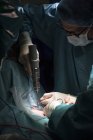 Chirurgien utilisant la perceuse pendant l'opération — Photo de stock
