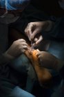Operazione mani chirurghi — Foto stock