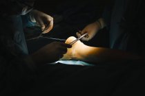 Cirurgiões mãos fazendo operação — Fotografia de Stock
