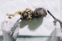 Crop medic's hands preparing fetus specimen with lancet. — Stock Photo