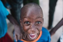 Goree, Senegal- December 6, 2017: Low angle portrait of expressive African kid shouting happily and looking at camera. — Stock Photo