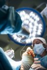 De abajo el tiro de los cirujanos que cosen el pie del paciente en la luz brillante de la lámpara . - foto de stock