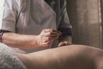 Therapeut führt Akupunktur-Behandlung durch — Stockfoto