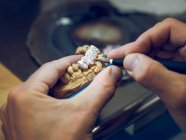 Dental technician applying enamel on mold — Stock Photo