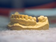 Зубна форма в лабораторії — стокове фото
