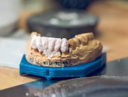 Искусственные зубы на столе — стоковое фото