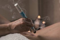 Therapist performing moxibustion treatment in massage room — Stock Photo