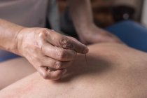 Terapeuta realizando tratamento de acupuntura no paciente — Fotografia de Stock