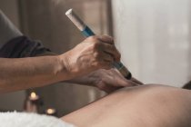 Terapista che esegue il trattamento di moxibustione in sala massaggi — Foto stock