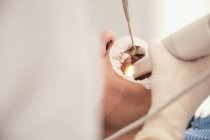 Die Hand des Zahnarztes in Handschuhen und Maske mit moderner Ausrüstung, um die Zähne des nicht erkennbaren Patienten in der Zahnarztpraxis zu scannen — Stockfoto