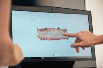 Hand of dentist demonstrating laptop with teeth scan to unrecognizable patient in clinic — Stock Photo