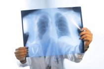 Nahaufnahme einer Ärztin in Uniform beim Betrachten eines Röntgenbildes im Raum — Stockfoto