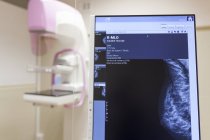 Unité de mammographie numérique moderne à la clinique et à l'écran — Photo de stock