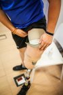 Amputated young man testing the new leg prosthesis — Stock Photo