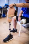 Joven amputado probando la nueva prótesis de pierna - foto de stock