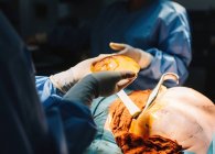 Обрізані руки лікаря, який тримає силіконовий імплантат грудей та голого пацієнта, що лежить з ланцет під час операції — стокове фото