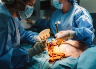 Невпізнаваний лікар хірург робить операцію з інструментами та медсестрою врожаю — стокове фото